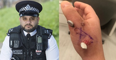 PC Aksit Ekrem underwent a gruelling five-hour operation